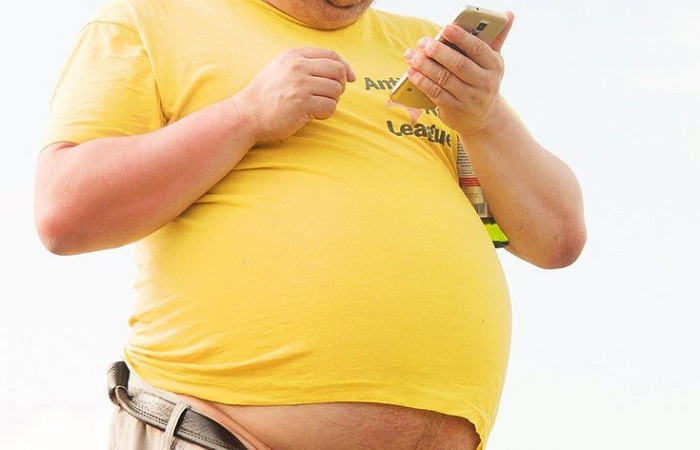 Penyandang Obesitas Rentan Terinfeksi COVID-19